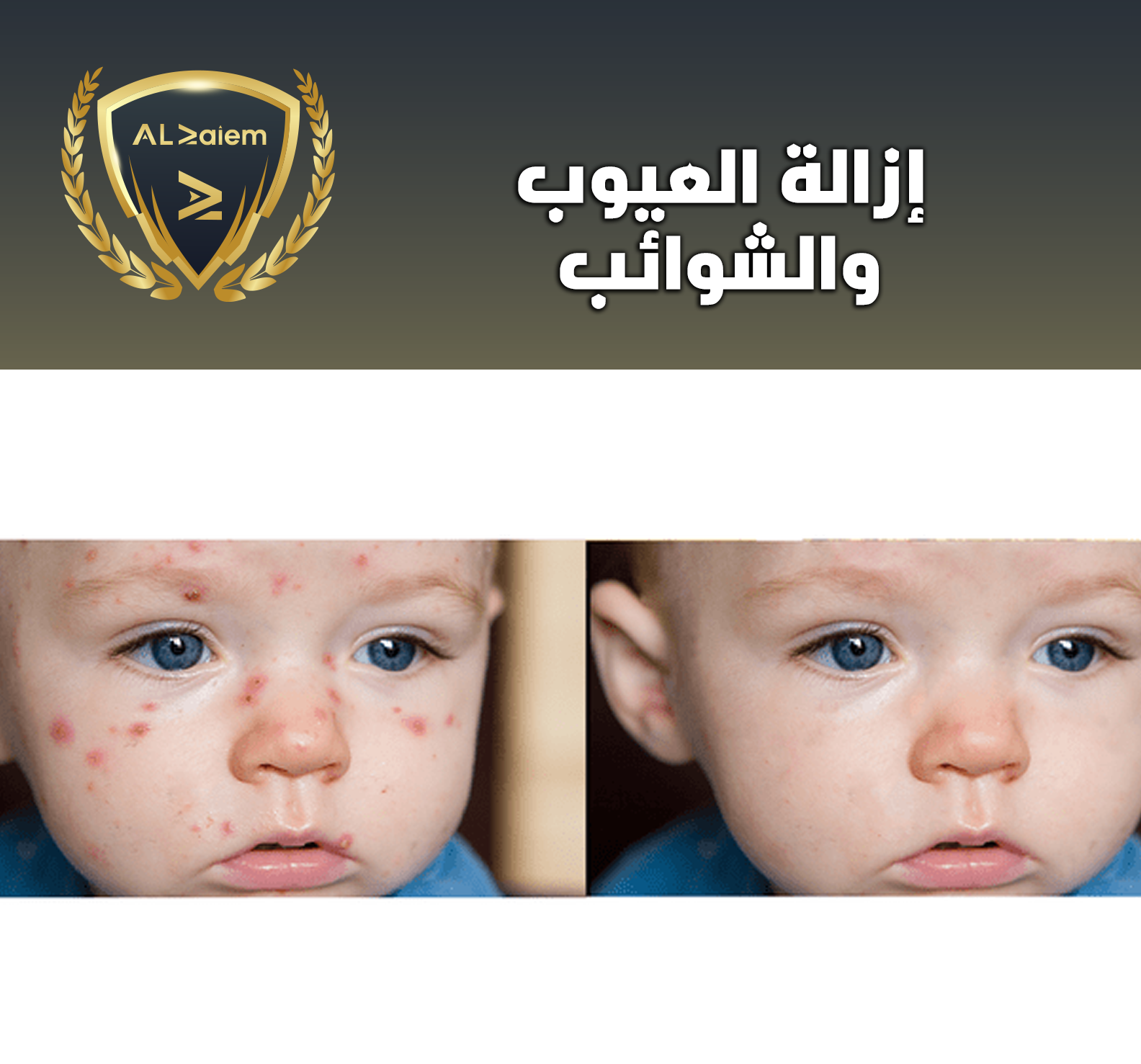 6 إزالة العيوب والشوائب